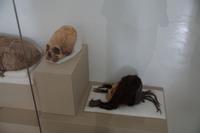 Schädeldeformierung in der Paracas-Kultur