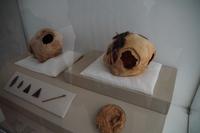 Schädeltrepanationen mit dem Obsidianmesser