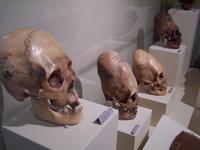 Schädel der Paracas-Kultur (Regionalmuseum Ica)