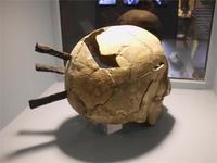 Drei Armbrustbolzen trafen diesen Mann im 14. Jh. vor Visby